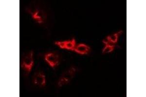 Immunofluorescent analysis of VPS37A staining in A549 cells. (VPS37A antibody)