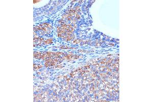 Immunohistochemistry of paraffin-embedded Rat ovary using B3GNT3 Rabbit pAb (ABIN7271204) at dilution of 1:100 (40x lens). (B3GNT3 antibody  (AA 120-240))