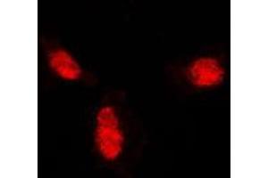 Immunofluorescence (IF) image for anti-Small Ubiquitin Related Modifier Protein 1 (SUMO1) (N-Term) antibody (ABIN7297228)