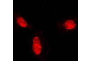Immunofluorescent analysis of SUMO1 staining in A431 cells. (SUMO1 antibody  (N-Term))