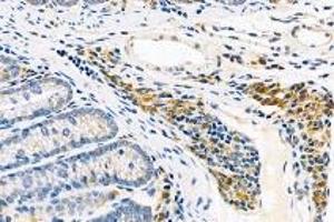 Immunohistochemistry analysis of paraffin-embedded mouse rectum using,FAM135B (ABIN7073910) at dilution of 1: 1000 (FAM135B antibody)