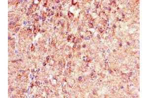 PHLDB2 antibody  (AA 734-1030)