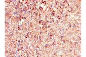 Immunohistochemistry of paraffin-embedded human adrenal gland tissue using ABIN7163679 at dilution of 1:100 (PHLDB2 antibody  (AA 734-1030))