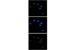 Immunofluorescence Microscopy of anti-Ash2 antibody Immunofluorescence Microscopy results of Rabbit anti-Ash2 antibody. (ASCL2 antibody  (C-Term))