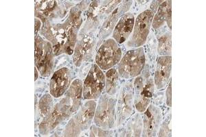 Immunohistochemical staining of human kidney with C14orf101 polyclonal antibody  shows cytoplasmic positivity in cells of renal tubules at 1:50-1:200 dilution. (C14orf101 antibody)