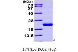 SDS-PAGE (SDS) image for Nudix (Nucleoside Diphosphate Linked Moiety X)-Type Motif 1 (NUDT1) (AA 1-156) protein (His tag) (ABIN667233) (NUDT1 Protein (AA 1-156) (His tag))