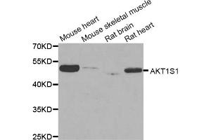 Western blot analysis of extracts of various cell lines, using AKT1S1 antibody (ABIN5973672) at 1/1000 dilution.