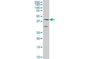 ELF3 monoclonal antibody (M01), clone 1D8 Western Blot analysis of ELF3 expression in A-431 .