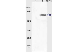Lane 1: mouse lung lysates Lane 2: mouse brain lysates probed with Rabbit Anti-MASP2 Polyclonal Antibody, Unconjugated (ABIN676223) at 1:200 in 4 °C. (MASP2 antibody  (AA 351-450))