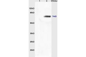 Lane 1: mouse lung lysates Lane 2: mouse brain lysates probed with Rabbit Anti-MASP2 Polyclonal Antibody, Unconjugated (ABIN676223) at 1:200 in 4 °C.