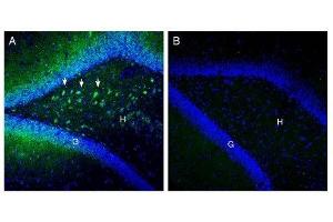 Expression of SLC25A12 in rat hippocampus. (SLC25A12 antibody  (Intracellular))