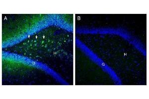 Expression of SLC25A12 in rat hippocampus.
