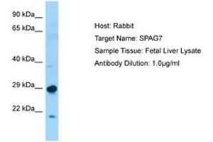 Image no. 1 for anti-Sperm Associated Antigen 7 (SPAG7) (N-Term) antibody (ABIN6750073) (SPAG7 antibody  (N-Term))