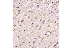 Immunohistochemistry (Paraffin-embedded Sections) (IHC (p)) image for anti-Dihydropyrimidinase-Like 4 (DPYSL4) antibody (ABIN7073734)