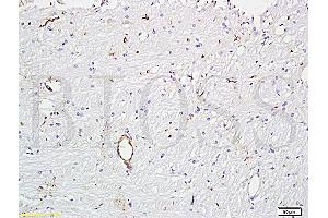 Formalin-fixed and paraffin embedded rat brain tissue (ABIN670506) at 1:300 followed by conjugation to the secondary antibody and DAB staining. (VWF antibody  (AA 701-800))
