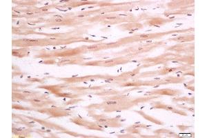 Paraformaldehyde-fixed, paraffin embedded rat heart tissue, Antigen retrieval by boiling in sodium citrate buffer(pH6) for 15min, Block endogenous peroxidase by 3% hydrogen peroxide for 30 minutes, Blocking buffer (normal goat serum) at 37°C for 20min, Antibody incubation with Rabbit Anti-PTPH1 Polyclonal Antibody, Unconjugated  at 1:200 overnight at 4°C, followed by a conjugated secondary and DAB staining (PTPN3 antibody  (AA 1-47))