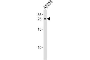 Western Blotting (WB) image for anti-Adenine Phosphoribosyltransferase (APRT) antibody (ABIN3001698)