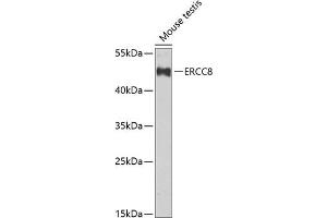 Western blot analysis of extracts of mouse testis, using ERCC8 Antibody (ABIN6134311, ABIN6140278, ABIN6140280 and ABIN6222611) at 1:1000 dilution. (ERCC8 antibody  (C-Term))