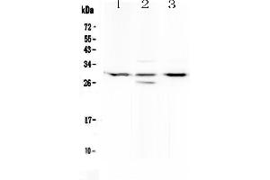 Western blot analysis of MED8 using anti-MED8 antibody . (MED8 antibody  (AA 1-195))