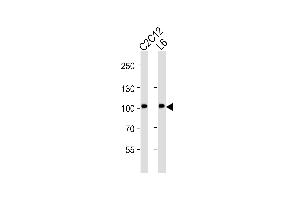 Western blot analysis of lysates from C2C12, L6 cell line (from left to right), using Musk Antibody (ABIN6242455 and ABIN6577083). (MUSK antibody  (AA 600-860))