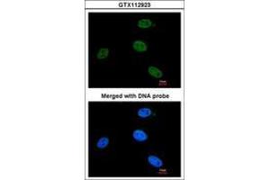 ERCC3 antibody  (AA 521-712)