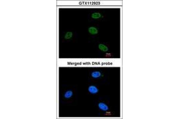 ERCC3 antibody  (AA 521-712)