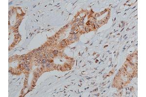 Immunohistochemistry (IHC) image for anti-Tumor Protein P53 (TP53) (pSer20) antibody (ABIN6255078)