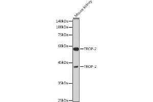 Western blot analysis of extracts of Mouse kidney, using TROP-2 antibody (ABIN7271104) at 1:1000 dilution. (TACSTD2 antibody  (AA 27-270))