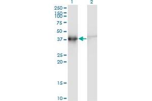 Western Blot analysis of ACTRT2 expression in transfected 293T cell line by ACTRT2 monoclonal antibody (M03), clone 2E10. (ACTRT2 antibody  (AA 209-299))