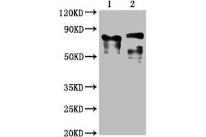 Western Blot Positive WB detected in: 1 lane: Recombinant proteins with LAG3, 2 lane: 293F whole cell lysate transfected with LAG3 All lanes: LAG3 antibody at 1:2000 Secondary Goat polyclonal to mouse IgG at 1/50000 dilution Predicted band size: 76, 88 KDa Observed band size: 76, 88 KDa Exposure time:5 min