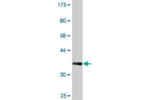 Western Blot detection against Immunogen (36. (SRPK1 antibody  (AA 371-470))