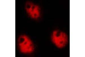ABIN6268828 staining Hela by IF/ICC. (DDIT3 antibody  (Internal Region))