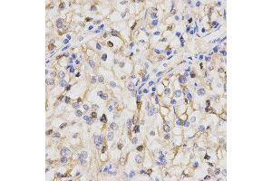 Immunohistochemistry (IHC) image for anti-Protein Phosphatase 2A Activator, Regulatory Subunit 4 (PPP2R4) (AA 1-323) antibody (ABIN1682265) (PPP2R4 antibody  (AA 1-323))