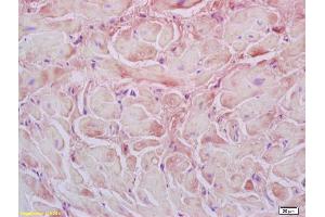 Formalin-fixed and paraffin embedded rat heart labeled with Rabbit Anti Desmuslin Polyclonal Antibody, Unconjugated (ABIN1387897) at 1:200 followed by conjugation to the secondary antibody and DAB staining (SYNM antibody  (AA 501-650))