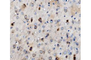 IHC analysis of MAP3K8 using anti-MAP3K8 antibody (ABIN4886663). (MAP3K8 antibody  (AA 9-193))