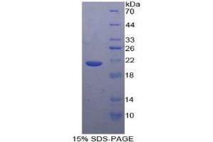SDS-PAGE (SDS) image for Tumor Necrosis Factor alpha (TNF alpha) ELISA Kit (ABIN6574142)