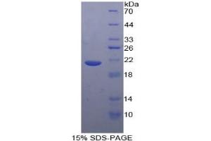 SDS-PAGE of Protein Standard from the Kit (Highly purified E.