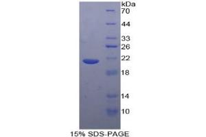 SDS-PAGE of Protein Standard from the Kit (Highly purified E. (TNF alpha ELISA Kit)