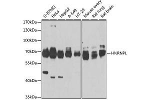 Western blot analysis of extracts of various cell lines, using HNRNPL antibody. (HNRNPL antibody)