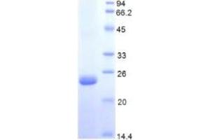 SDS-PAGE (SDS) image for Protein S (PROS) ELISA Kit (ABIN6730912)