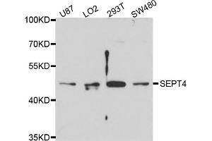 Western blot analysis of extracts of various cell lines, using SEPT4 antibody (ABIN4905117) at 1:1000 dilution. (Septin 4 antibody)