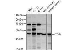 Western blot analysis of extracts of various cell lines, using ETV6 antibody (ABIN3022302, ABIN3022303, ABIN3022304, ABIN1512878 and ABIN6218719) at 1:1000 dilution. (ETV6 antibody  (AA 1-300))