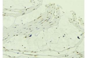 ABIN6279318 at 1/100 staining Mouse muscle tissue by IHC-P. (CCDC8 antibody  (N-Term))