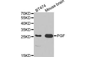 Western blot analysis of extracts of various cell lines, using PGF antibody. (PLGF antibody  (AA 19-170))