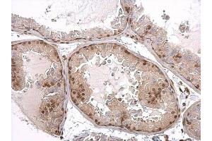 IHC-P Image Androgen Receptor antibody [N1], N-term detects Androgen Receptor protein at nucleus on mouse prostate by immunohistochemical analysis. (Androgen Receptor antibody  (N-Term))
