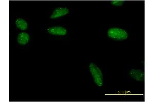 Immunofluorescence (IF) image for anti-Small Ubiquitin Related Modifier Protein 1 (SUMO1) (AA 1-101) antibody (ABIN948607)
