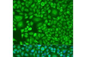Immunofluorescence analysis of U2OS cells using RARB Polyclonal Antibody at dilution of 1:100. (Retinoic Acid Receptor beta antibody)