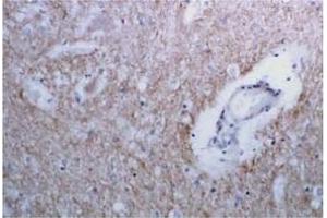 Immunohistochemistry (IHC) image for anti-Syntaxin 1A (Brain) (STX1A) antibody (ABIN492371) (STX1A antibody)