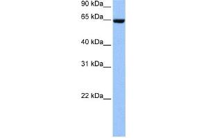 WB Suggested Anti-COL4A3BP Antibody Titration: 0.