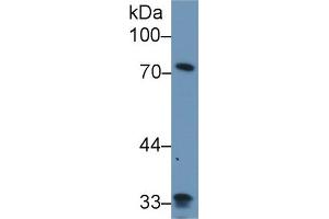 Western Blot; Sample: Human Lung lysate; Primary Ab: 1µg/ml Rabbit Anti-Human ZYX Antibody Second Ab: 0. (ZYX antibody  (AA 377-523))